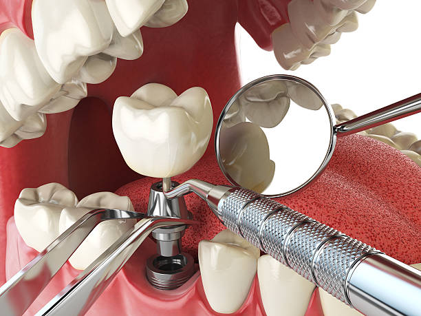 Best Emergency Dental Surgery in Lake Forest, IL